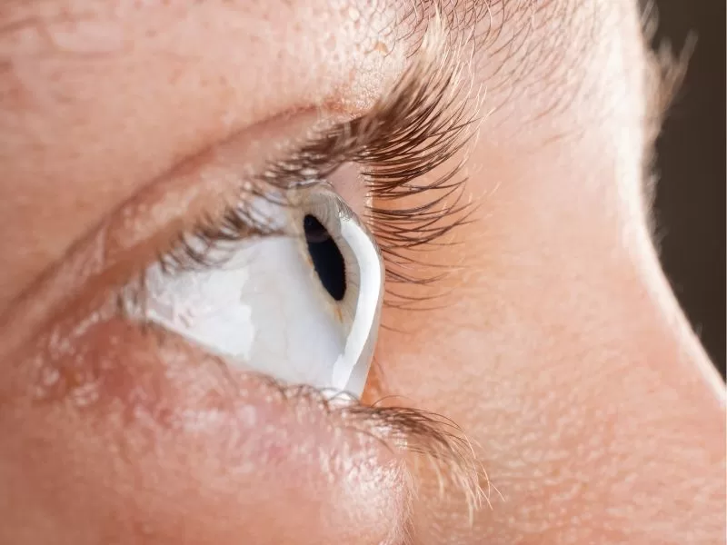 topografía corneal