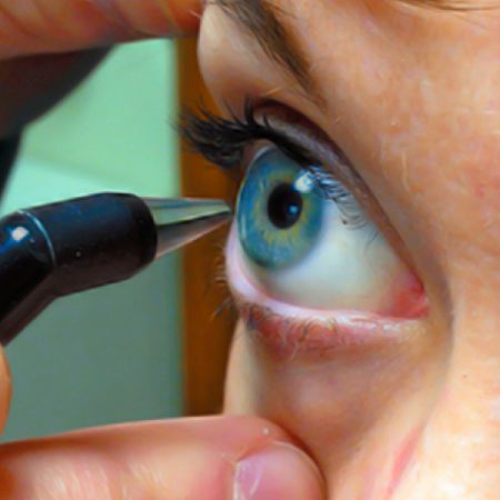paquimetria-corneal paquimetria-corneal